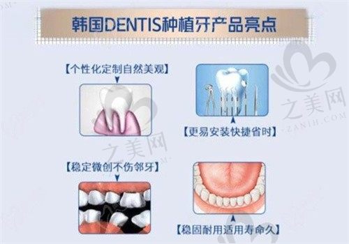 我在汉中市齿博士花了4800种了一颗韩国登斯特种植牙,刘科伽院长很专业