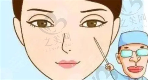郑州东方贺洁修复双眼皮技术好吗