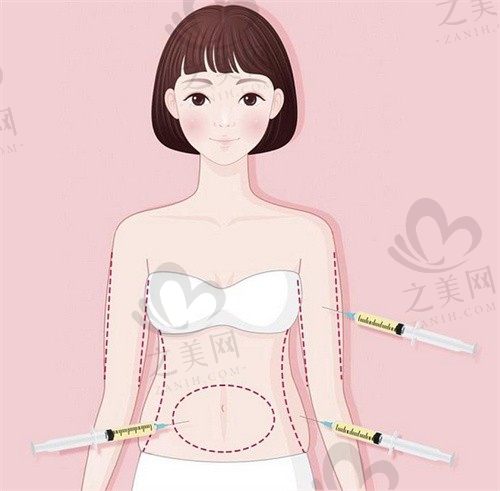 北京樱桃医疗美容医院金尚训腰腹吸脂8000元起，个性化定点吸脂，效果好不易反弹