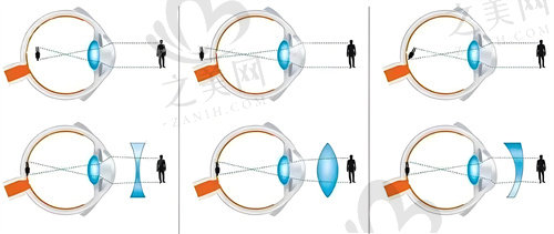 常州华厦谱瑞眼科医院患者口碑如何.jpg