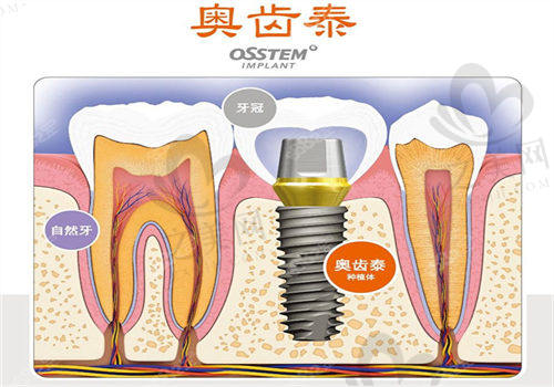 汉中小白象口腔医院在哪里？