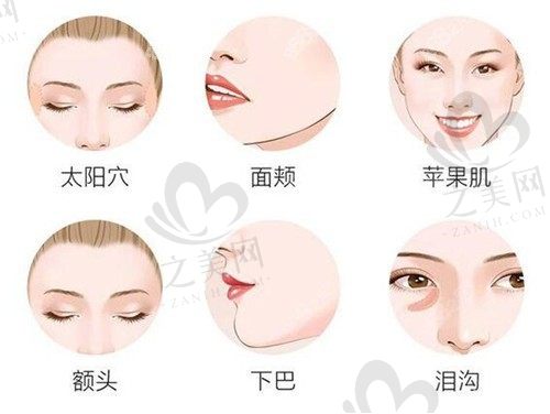 北京美媛荟医疗美容门诊部李晓东面部提升手术35800元起，提拉紧致肌肤专治垮脸