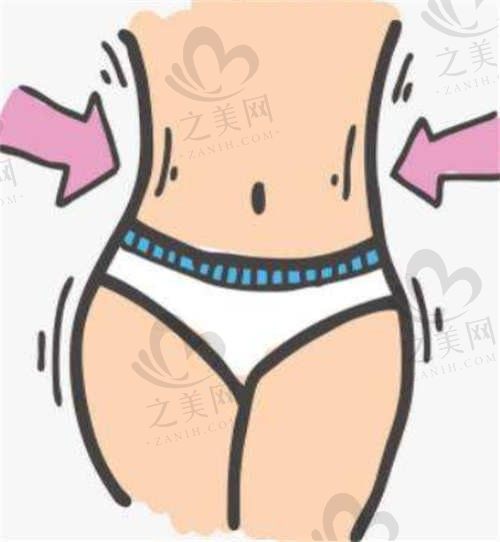 昆明杰西艾整形郑延清腰腹360°环吸价格15000元起，定位吸脂，均匀塑形