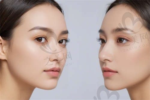 种植牙价格怎么样_之美网