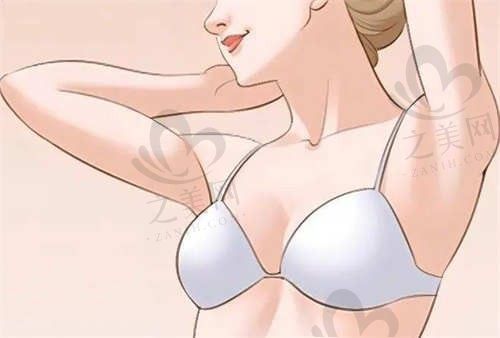 广州可玉医疗美容医院唐志荣内窥镜隆胸价格30000元起，切口小恢复快