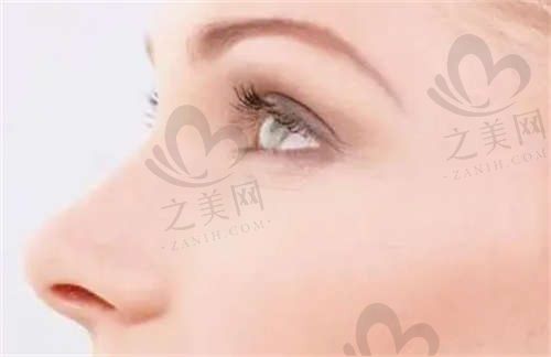 深圳皇佳亿美王树坚隆鼻价格12000元起，二十余年经验手法很老道