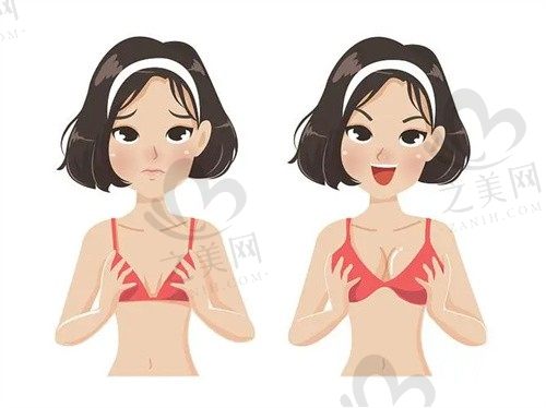 重庆当代整形外科医院牙祖蒙自体脂肪隆胸8800元起，隆胸效果好无副作用  
