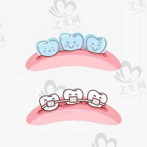 达州华誉口腔医院李天国医生做柯威尔种植体仅需2680元起,附医院口碑