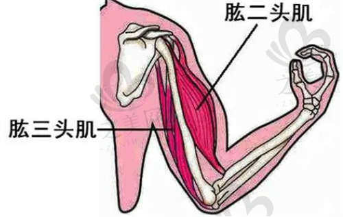 手臂吸脂项目介绍