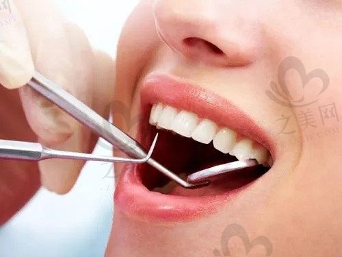 北京恩贝口腔门诊怎么样?儿童牙科口碑好,洗牙价格实惠
