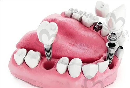 成都西南口腔医院怎么样?地址电话公布,附种植牙/牙齿矫正价格表!