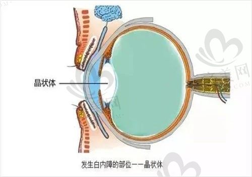 珠海希玛林顺潮眼科医院白内障手术怎么样?提供多种手术方式,术后成果好!