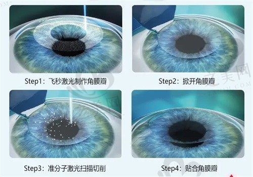 种植牙价格怎么样_之美网