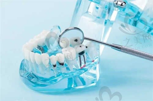 包头鹿城口腔医院美加锆全瓷冠3169元起，鹿城口腔医院价格表