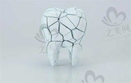 漯河众植口腔医院威兰德全瓷冠4299元起，正规口腔诊疗服务