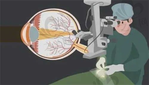 杭州近视眼手术费用＋医院排名揭秘，爱尔/华厦/茗视佳眼科很不赖！