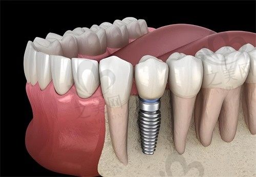 南阳植得口腔医院是正规医院吗？地址电话查询，为您解答疑惑，正规资质值得信赖！