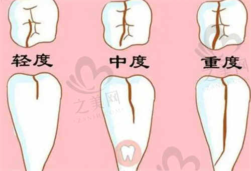 许昌口腔医院特色项目及技术