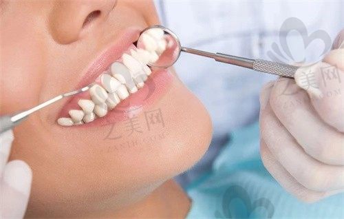 金华众悦口腔门诊部刘忠臣医生全口种植26800元，高品质种植牙技术