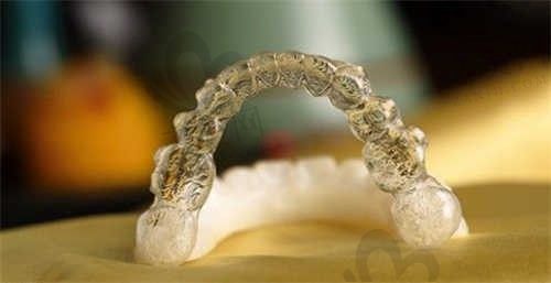 惠城皓齿口腔门诊部全玉莲医生隐形矫正8800元起，从患者的分享来看矫正结果真不错