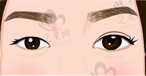 哈尔滨艺星医疗美容医院正规吗？瘦脸针/玻尿酸/热玛吉价格优惠，真实案例反馈告诉你