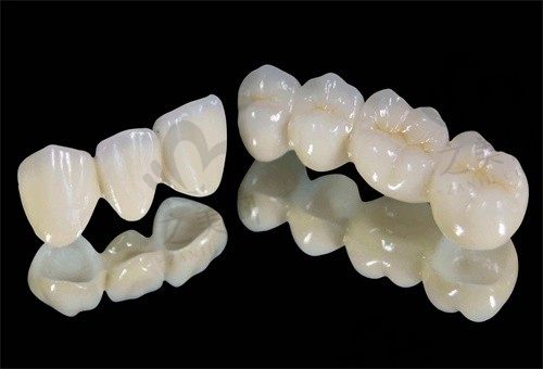   大连泰康拜博口腔王运福超薄瓷贴面美学修复2980元起，修复牙齿很不错 