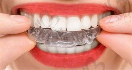 辽宁锦州美康口腔医院徐显亮医生隐形矫正贵吗？隐适美矫正2w元起，附患者分享