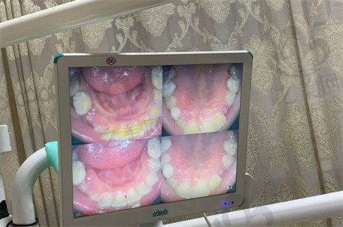桂林美皓囗腔门诊部在哪里?地址电话全公开,看牙价格一览表