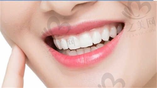 石家庄奥雅口腔门诊部激光牙周治疗全口635元起，价格表详细解读