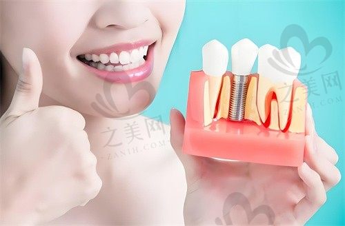 长沙中诺口腔医院种植牙多少钱？全口种植、单颗种植、微创种植价格详解