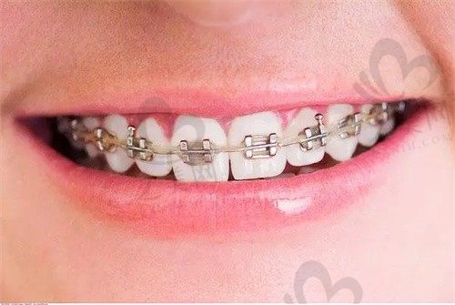 西安中诺口腔医院可靠吗?口碑如何?真实患者评价,全面解析医院实力