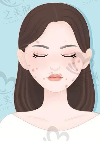 上海联合丽格2025鼻整形&抗衰价格全公开：从初鼻到修复、微整到光电，真实案例+费用透明解析