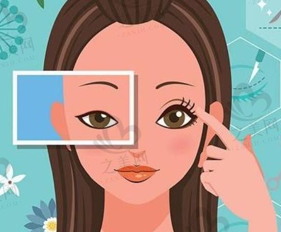 上海双眼皮失败修复医生推荐哪些？杜园园/ 杨亚益/张余光修复技术的核心优势分析