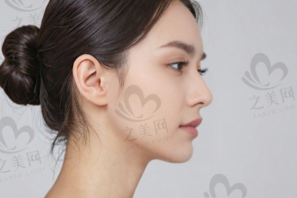 南京施尔美拉皮技术好的医生:孙欣/李彤彤医生拉皮技术好杨东旭也不错