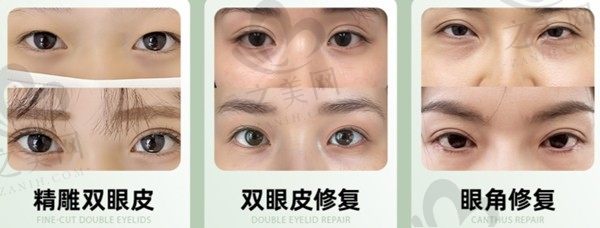 魏志香是不营销医生,双眼皮修复的成就和荣誉很高&案例丰富费用中等附坐诊医院