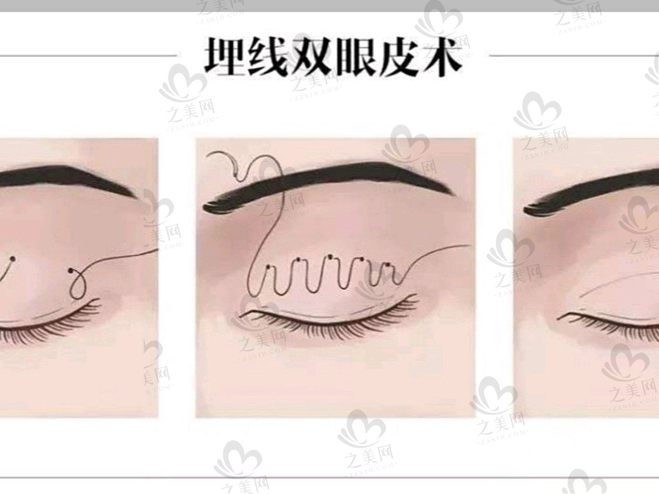 af548884186ccc34bc7be806fc3c139d.jpg