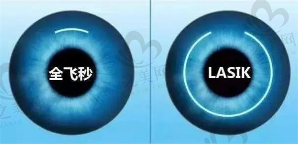 郑州视光眼科医院2025收费价格表