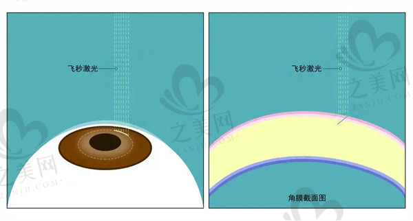 郑州视光眼科医院2025收费价格表