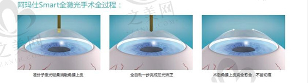 郑州视光眼科医院2025收费价格表
