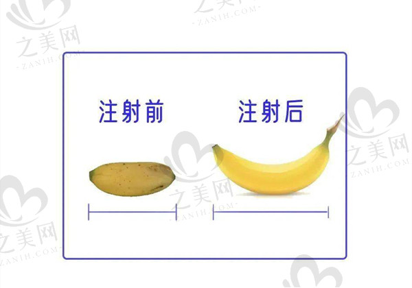安阳做生殖增粗哪个医院好