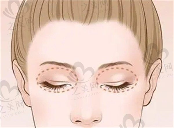 北京八大处整形医院怎么样？三甲公立/于晓波双眼皮穆大力隆胸口碑佳