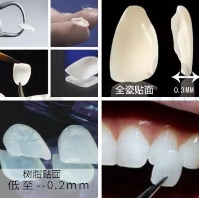 洗不白的牙齿怎么办?济南市口腔医院刘莹为你解惑