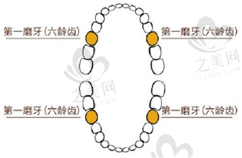 六龄齿是哪颗牙,窝沟封闭有必要做吗?坏了要怎么补救