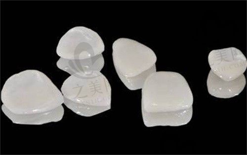 做牙齿贴面要多久时间?分享牙贴面全过程和步骤