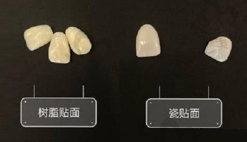 牙齿贴面发黄了怎么办,是哪些原因造成的呢?可以洗牙吗