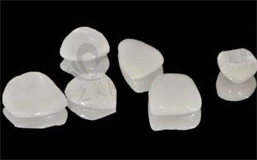 一般什么情况下做牙贴面?树脂贴面和瓷贴面有什么区别?