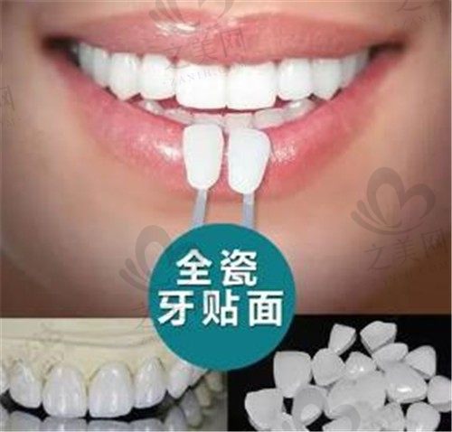 明星牙齿怎么那么白?是怎么弄的