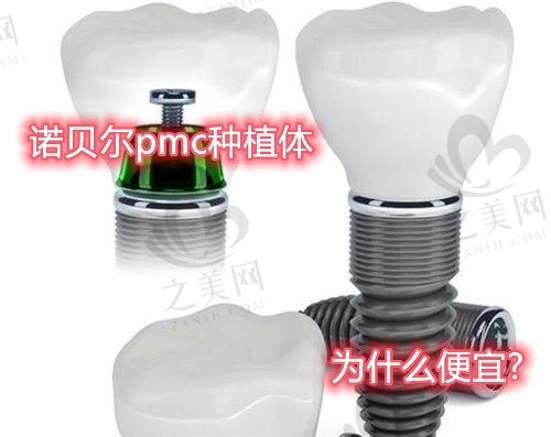 诺贝尔pmc种植体为什么便宜,和pcc种植体比哪个好?