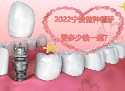 2022宁波做种植牙要多少钱一颗,老人全口种植牙10万够不?