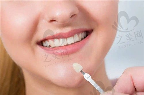 牙贴面掉了之后怎么办?要是牙齿贴面卸掉不再贴了可以吗